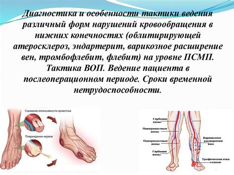 Диагностика покалывания в конечностях