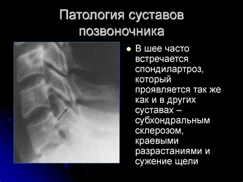 Диагностика рыбьего позвоночника