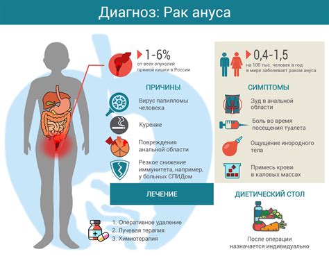 Диастаз: причины и последствия