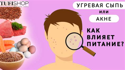 Диета и питание для очищения кожи от прыщей у подростков