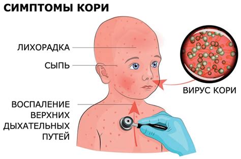 Дополнительные методы диагностики ветрянки у ребенка