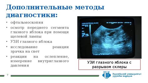 Дополнительные методы диагностики эозинофильного осцилляторного сегмента