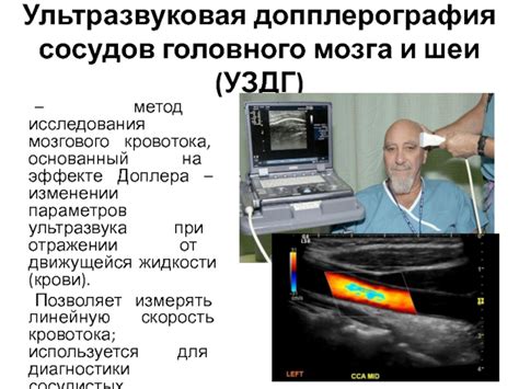 Допплерография - изучение кровотока и сосудов