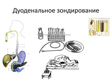 Дуоденальное зондирование дома: возможность и инструкция