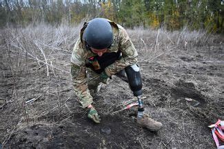 Жизнь после потери конечностей