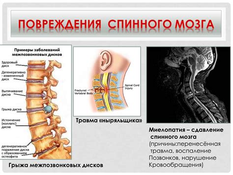 Защитный механизм спинного мозга