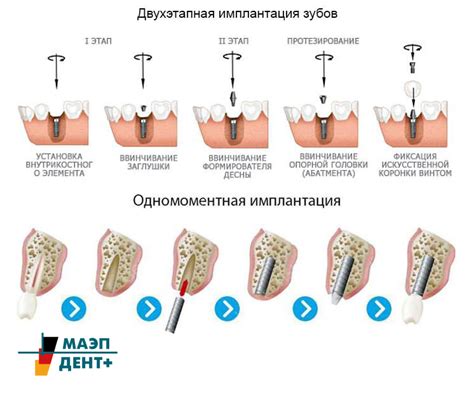 Здоровье десны: эффективные методы восстановления