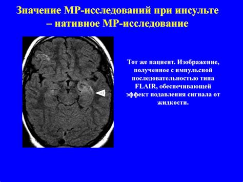 Значение МР-сигнала при диагностировании заболеваний