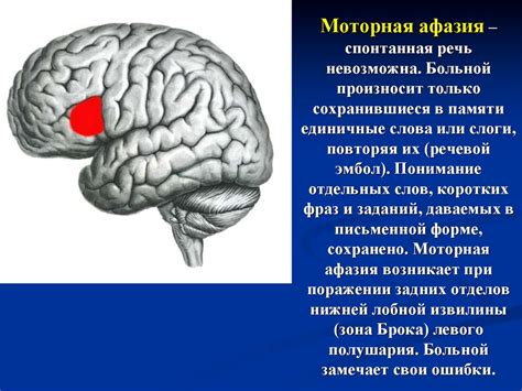 Значение праксиса и гнозиса в диагностике неврологических заболеваний