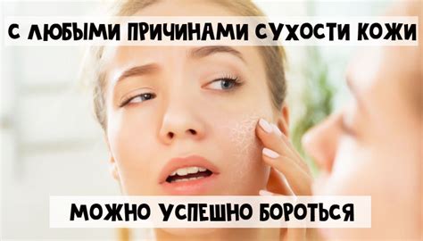 Избегайте сухости кожи