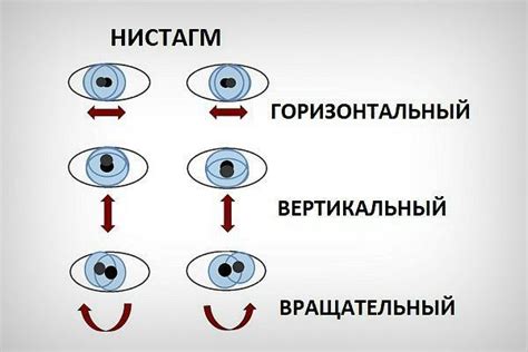 Избегание давления на глазные яблоки