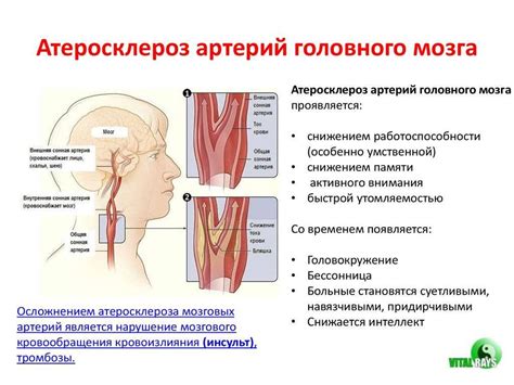 Изучение основных факторов риска для здоровья сосудов шейного отдела