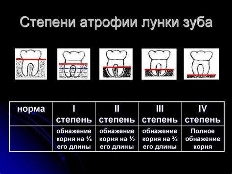 Изучите основные принципы конструирования ваймов