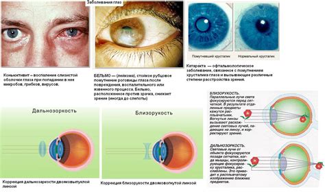 Инфекции и заболевания глаз