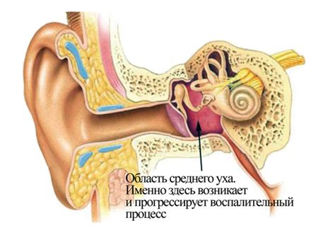 Инфекция внутри уха