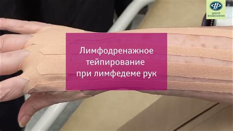 Использование специальных средств для уменьшения отека