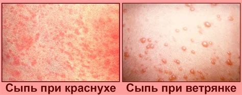 Используйте антипиретики