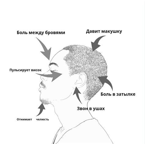 Источники головной боли и их классификация