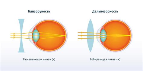 Какие особенности характерны для зрения минус 7?