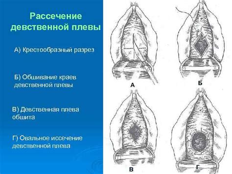 Какие повреждения может вызвать сырость