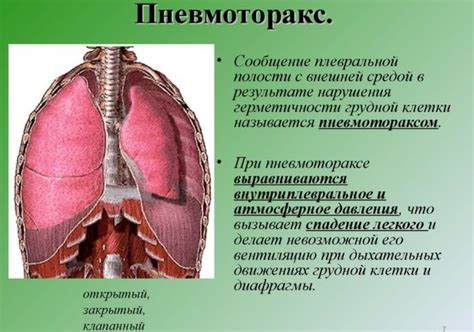 Какие последствия могут возникнуть при интенсивных очагах в легких?