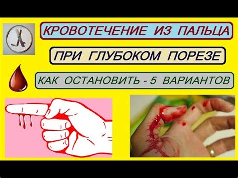 Как быстро остановить кровотечение после ушиба пальца