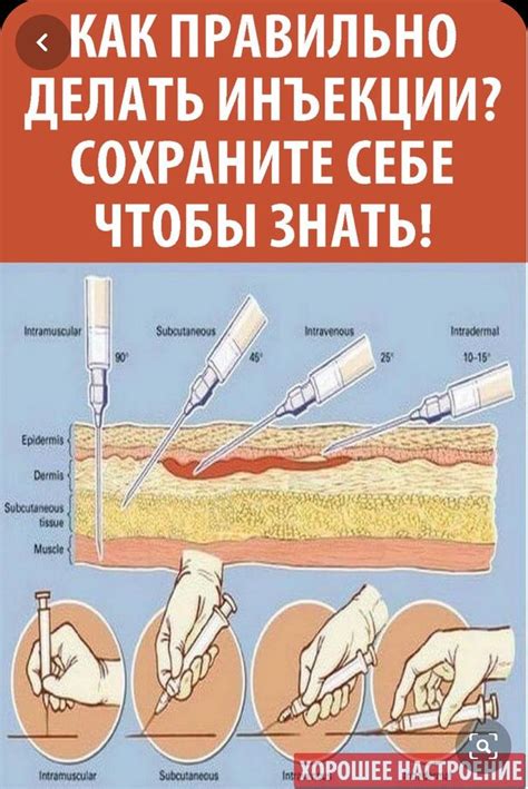 Как выбрать место для инъекции Оземпика