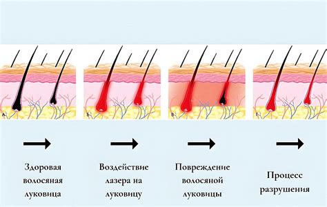 Как долго держится эффект от удаления жира?