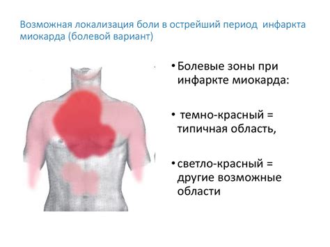 Как избежать болей в грудной клетке: полезные рекомендации