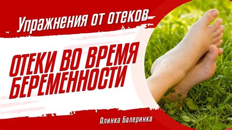 Как избежать отеков ног во время поездки