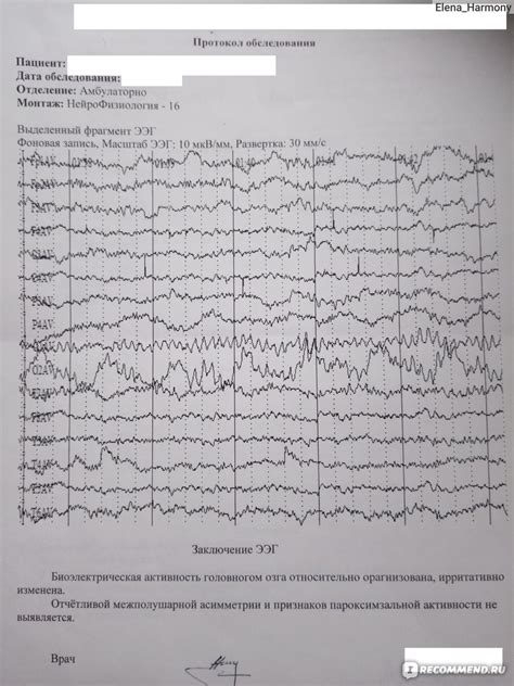 Как использовать результаты ЭЭГ для определения диагноза и назначения лечения