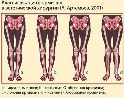 Как исправить длину ног вашей мамы