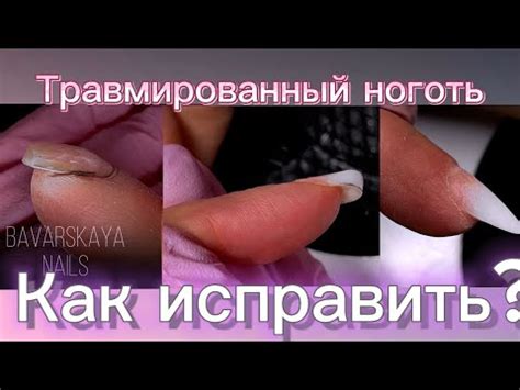 Как исправить поломку ногтя самостоятельно?