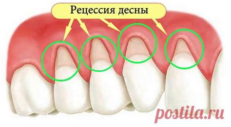 Как не допустить потерю клеевых свойств карандаша