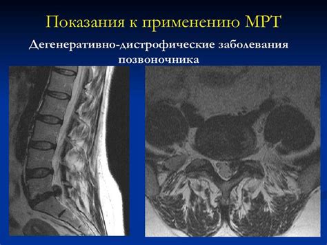 Как определить ДДЗП: признаки и симптомы