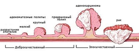 Как определить и помочь при опухоли одной стороны лица