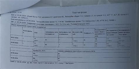 Как правильно интерпретировать результаты