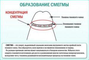 Как правильно очистить крайнюю плоть ребенка