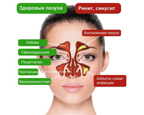 Как правильно очищать носовые пазухи