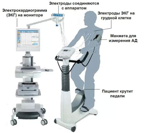 Как проводится ЭКГ и ЭКГ с нагрузкой