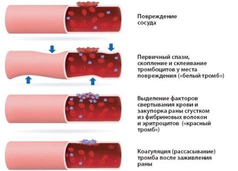 Как происходит свертывание крови