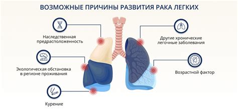 Как распознать болезненные ощущения в легких: признаки и методы определения