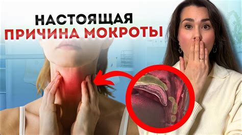 Как увеличить количество мокроты в горле