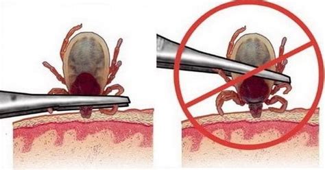 Как удалить клеща: полезные советы и рекомендации