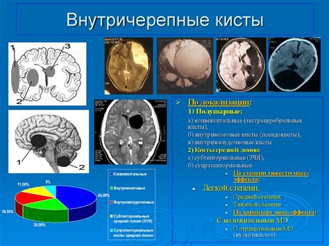 Киста в голове: опасности и запреты