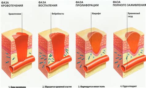 Ключевые этапы лечения душевных ран