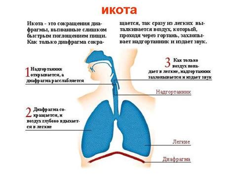 Когда икота становится проблемой?