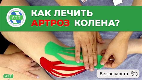 Когда обратиться к врачу при вывихе колена