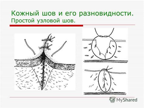 Кожный контакт и его польза