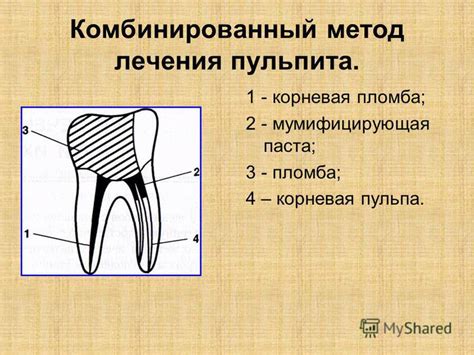 Комбинированный метод